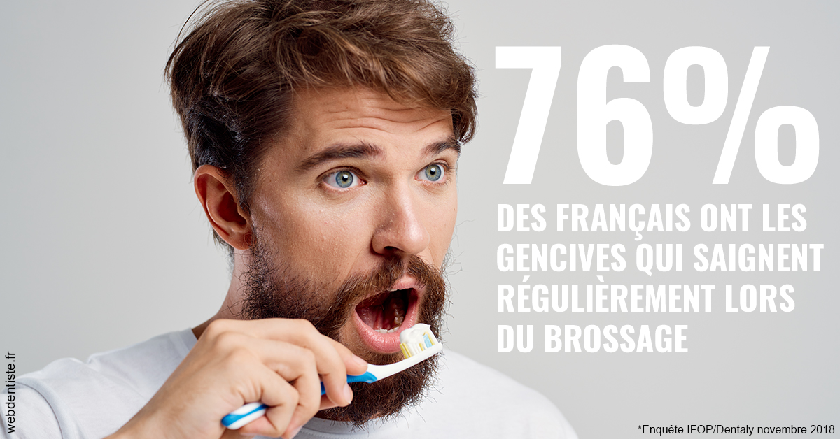 https://dr-brincat-thierry.chirurgiens-dentistes.fr/76% des Français 2