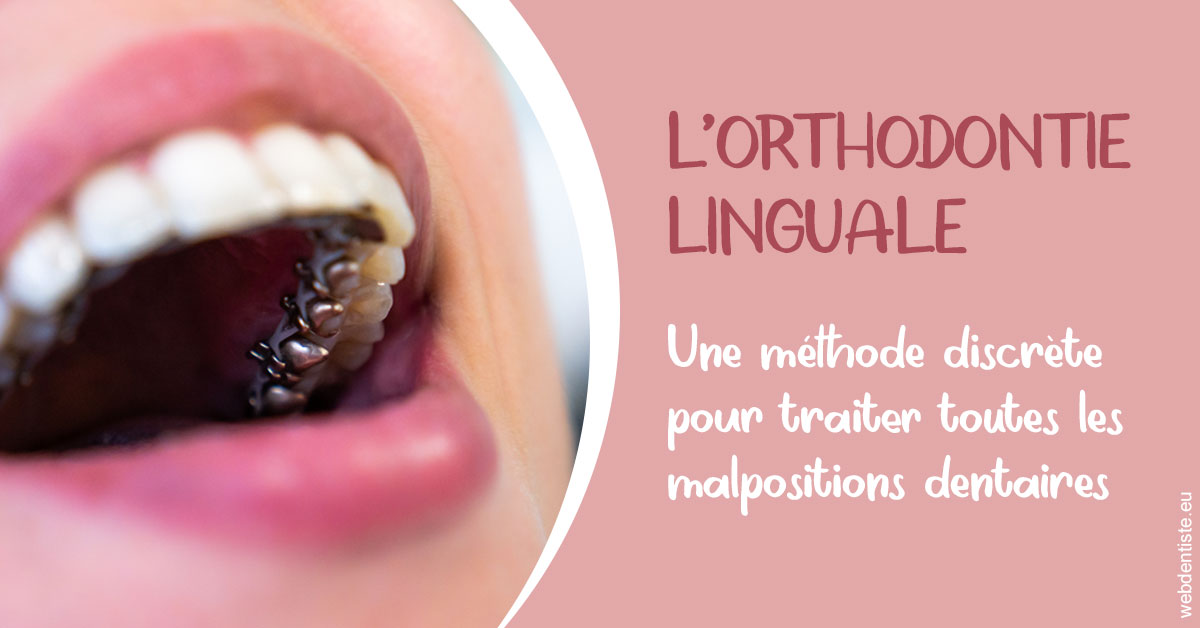 https://dr-brincat-thierry.chirurgiens-dentistes.fr/L'orthodontie linguale 2