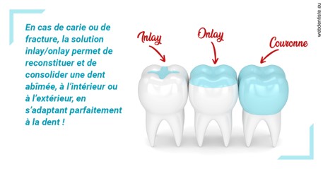 https://dr-brincat-thierry.chirurgiens-dentistes.fr/L'INLAY ou l'ONLAY