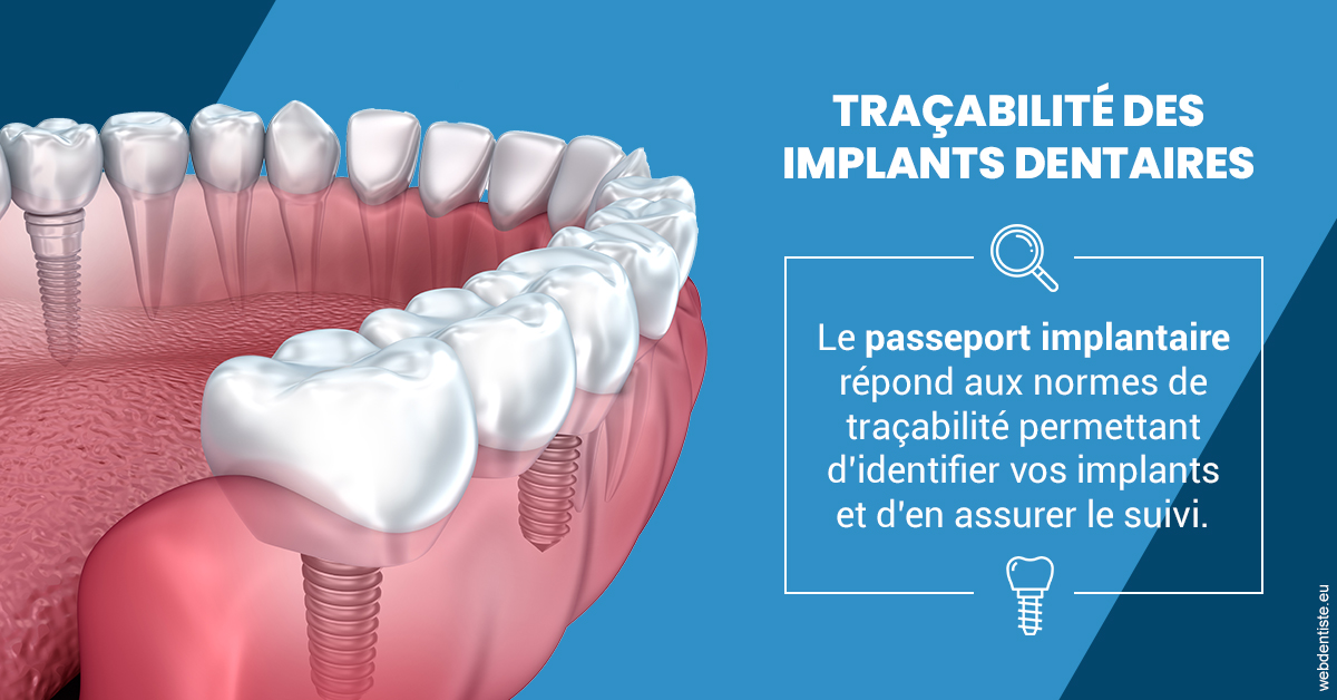 https://dr-brincat-thierry.chirurgiens-dentistes.fr/T2 2023 - Traçabilité des implants 1