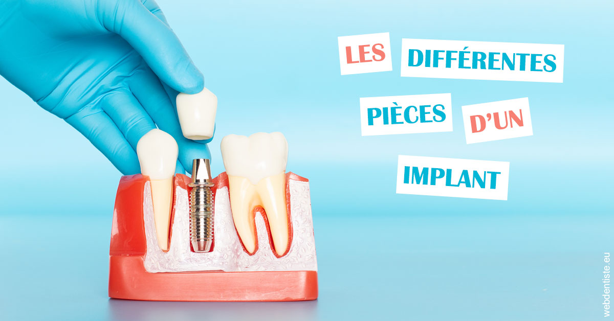https://dr-brincat-thierry.chirurgiens-dentistes.fr/Les différentes pièces d’un implant 2