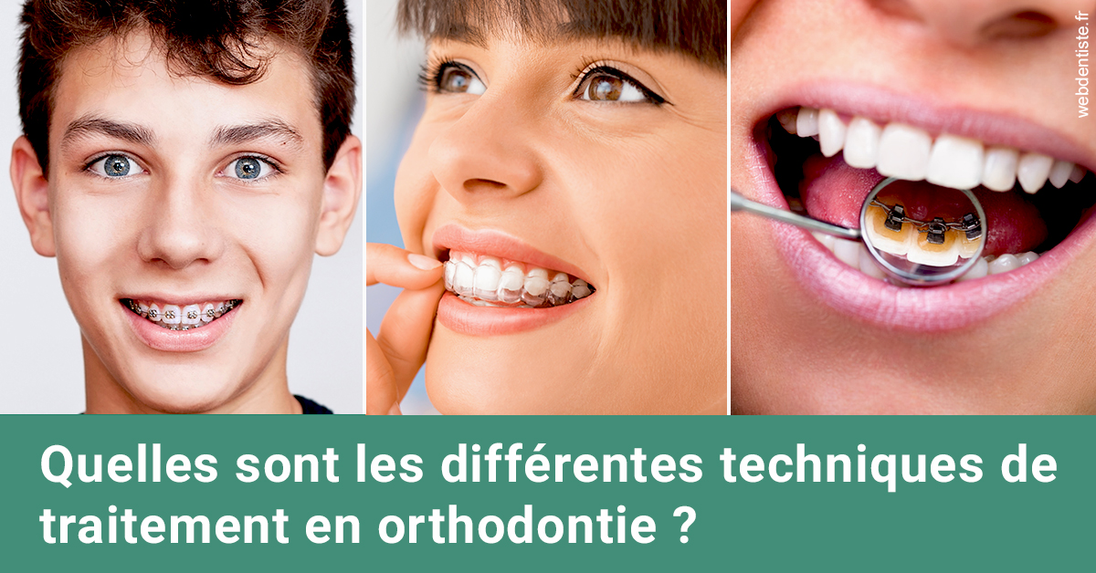 https://dr-brincat-thierry.chirurgiens-dentistes.fr/Les différentes techniques de traitement 2