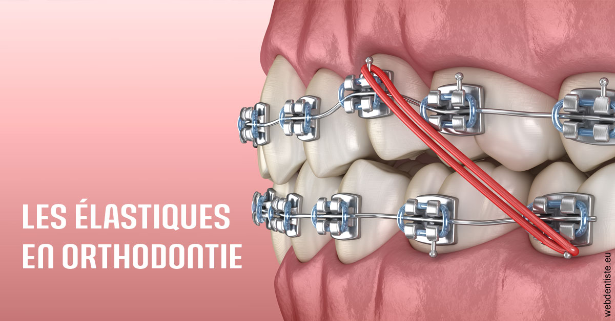 https://dr-brincat-thierry.chirurgiens-dentistes.fr/Elastiques orthodontie 2