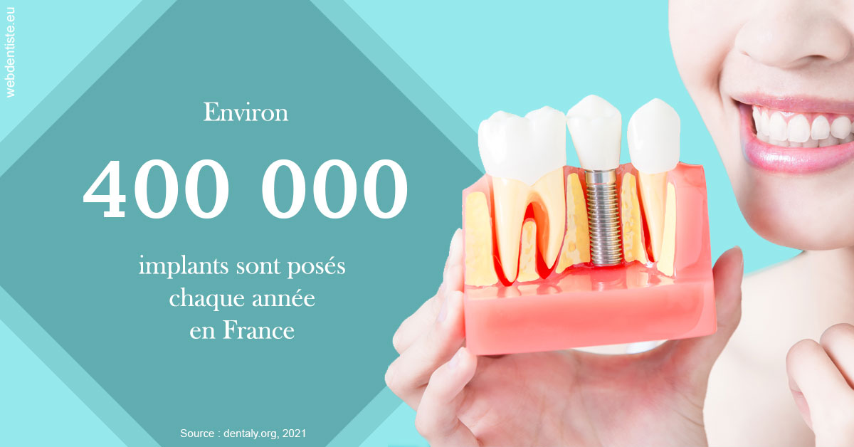 https://dr-brincat-thierry.chirurgiens-dentistes.fr/Pose d'implants en France 2